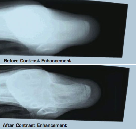 Software for Image Contrast Enhancement Medical Design Briefs